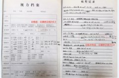 宁波爱尔光明眼科:5岁弱视孩子戴镜视力仅0.3,成功逆袭到1.0